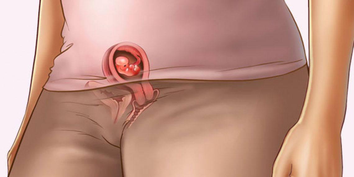 Así está tu cuerpo en la semana 6 de embarazo