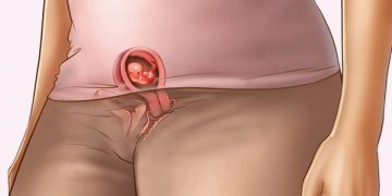 Así está tu cuerpo en la semana 6 de embarazo