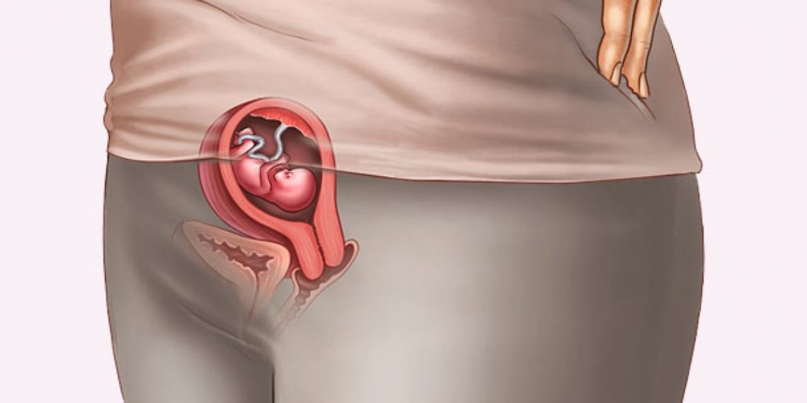 Embarazo 9 semenas así se ve tu cuerpo